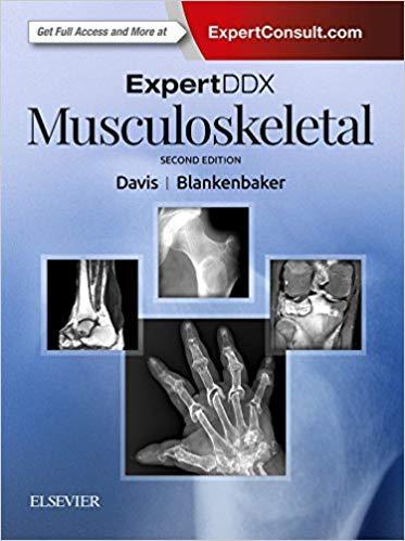 ExpertDDx اسکلتی عضلانی - رادیولوژی